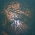 alopeciamale2.jpg