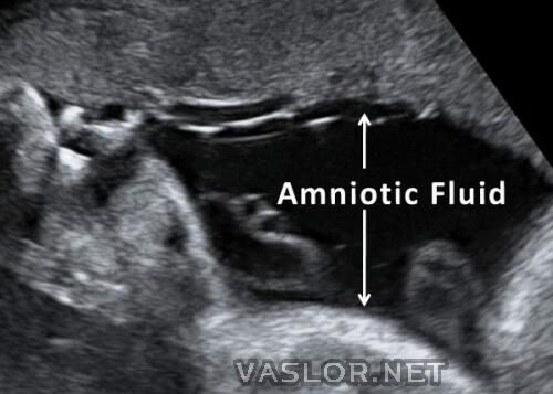 amniotic_fluid.jpg