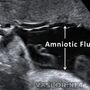 amniotic_fluid.jpg