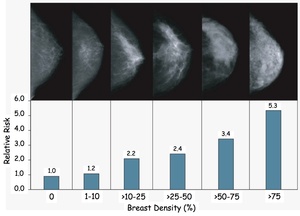 breast_density.jpg