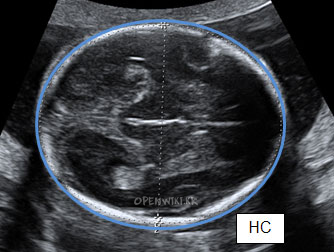 fetal_biometry-231711.png