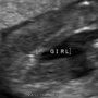 fetal_genitalia_girl_15-16_09.jpg
