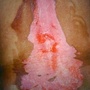 misuse_vitiligo8-612.jpg