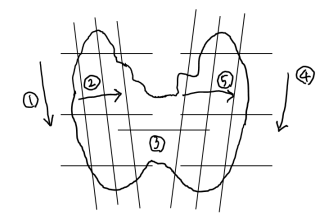 thyroid_ultrasonography_0502.png