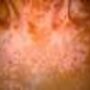 vitiligo_puva2.jpg