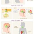 고프로락틴혈증.jpg
