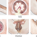성병_1020153140.png