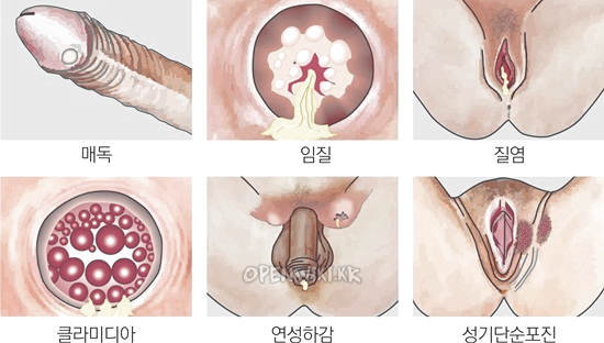 성병_1020153140.png