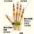 통풍_0616.png