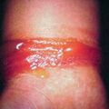 acd_rubber2000-334.jpg