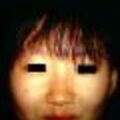 alopecia8-8532.jpg