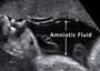 med:amniotic_fluid.jpg