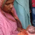 anencephaly_0322214721.png