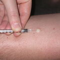 bcg_intradermal.jpg