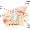 biceps_tendinitis_4627.png