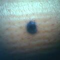 blusnevus4-1029.jpg