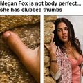 brachydactyly.jpg