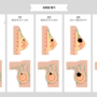 breast_cancer_3251.png