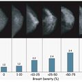 breast_density.jpg