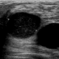 breast_v_l1224120411.png