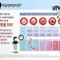 cervical_cancer.webp