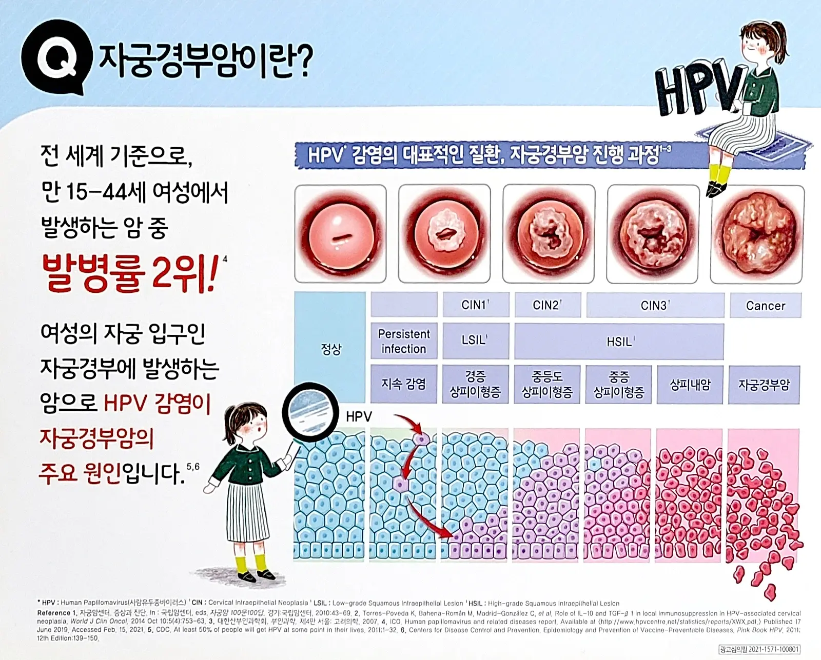 cervical_cancer.webp