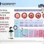 cervical_cancer.webp