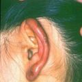 chilblain482.jpg