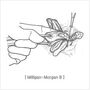 excision_and_ligation02.jpg