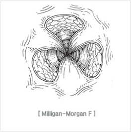 excision_and_ligation05.jpg