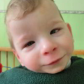 fetal_alcohol_syndrome_0915182740.png