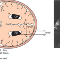 fetal_biometry-032708.png