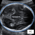 fetal_biometry-231711.png
