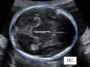 med:fetal_biometry-231711.png