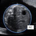 fetal_biometry-231807.png