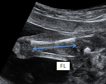 fetal_biometry-231908.png