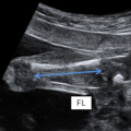 fetal_biometry-231908.png