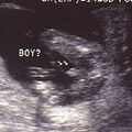 fetal_genitalia_boy_15-16_06.jpg