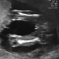 fetal_genitalia_girl_15-16_02.jpg