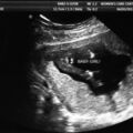 fetal_genitalia_girl_15-16_05.jpg