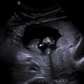 fetal_genitalia_girl_15-16_06.jpg