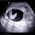 fetal_genitalia_girl_15-16_07.jpg