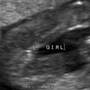 fetal_genitalia_girl_15-16_09.jpg