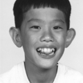 fragile_x_syndrome_3118.png