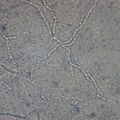 fungus010214-2.jpg