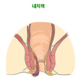 hemorrhoid_1636.png