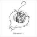 high_ligation_and_complete_closure03.jpg