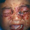 hsimplex21.jpg