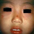 hsimplex22.jpg