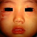 hsimplex23.jpg